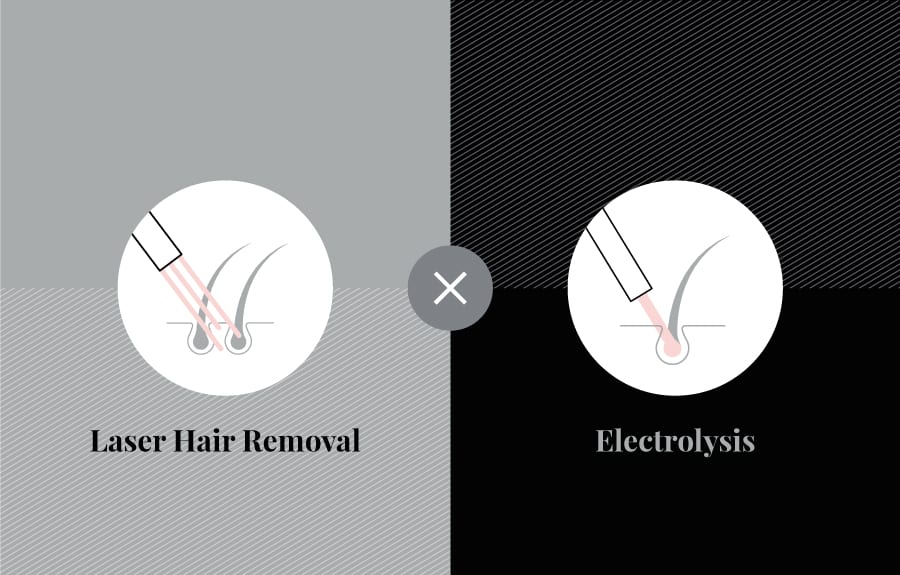 What is the difference between electrolysis and laser hair removal
