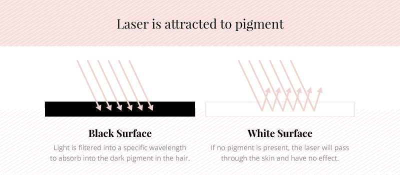 Laser Hair Removal