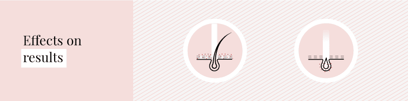 Effects not shaving properly has on results of laser hair removal