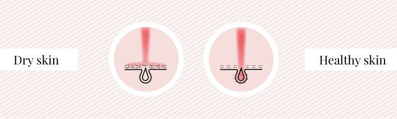 Laser on healthy skin and on dry skin