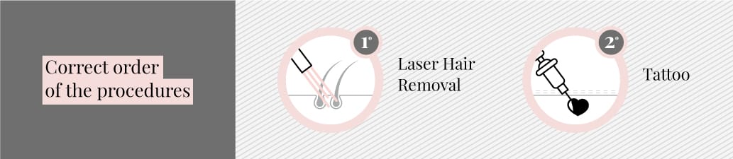 have laser first then get a tattoo