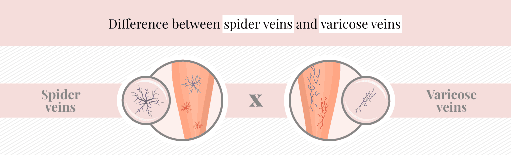 Different types of veins