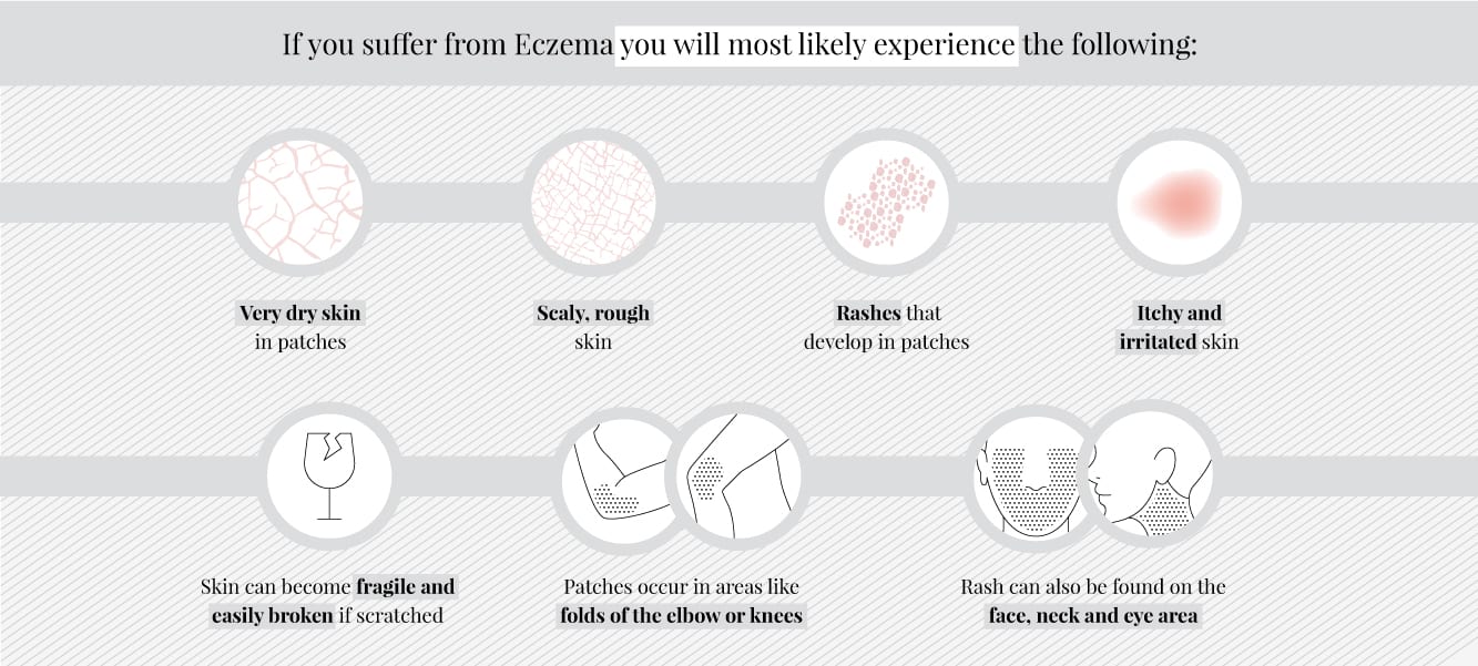Eczema and laser hair removal 