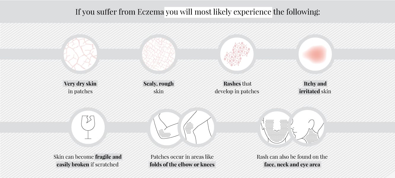 Follicular Eczema Symptoms Treatment and Prevention