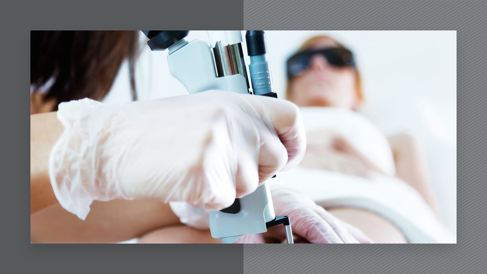 Skin conditions and laser hair removal