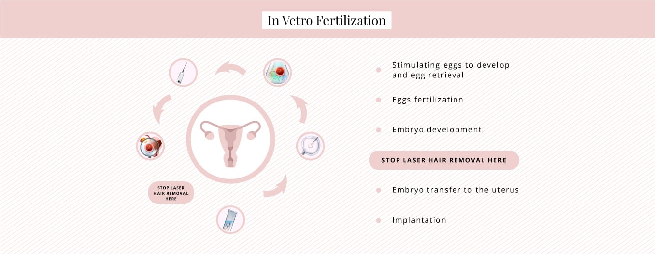 Can you have laser hair removal if you are undergoing IVF treatment?