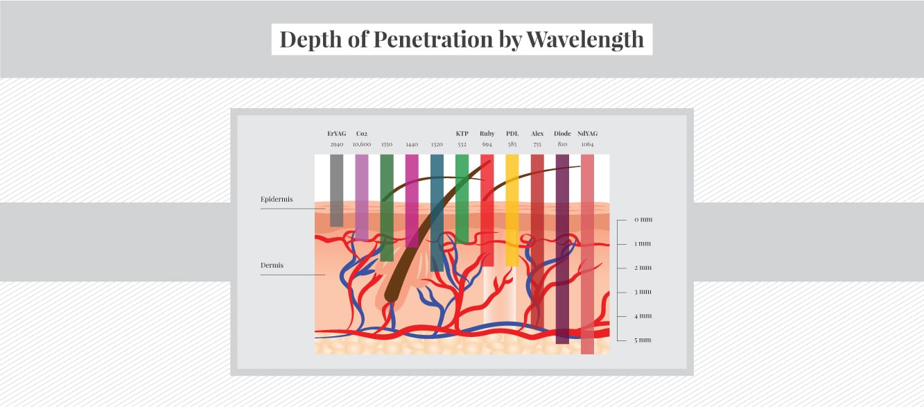 Depth of penetration of laser for dark skin types