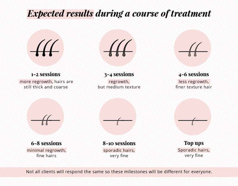 Expected results after a course of laser hair removal
