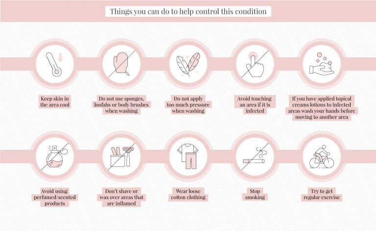 Hidradenitis suppurativa and laser hair removal | Urbana