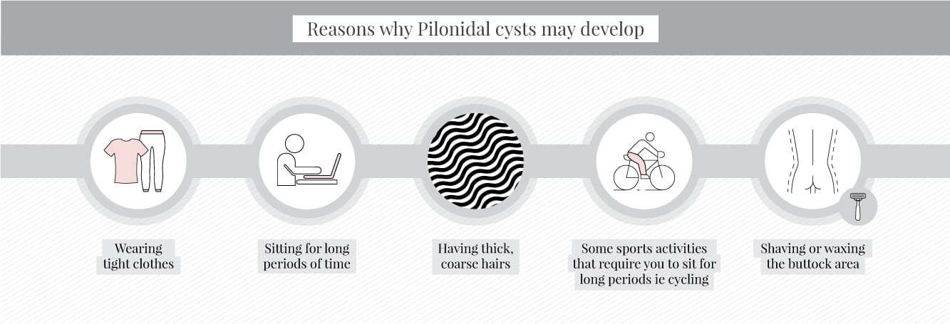 Reasons why pilonidal cysts develop