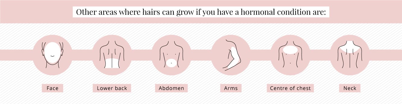 Pale Areolas