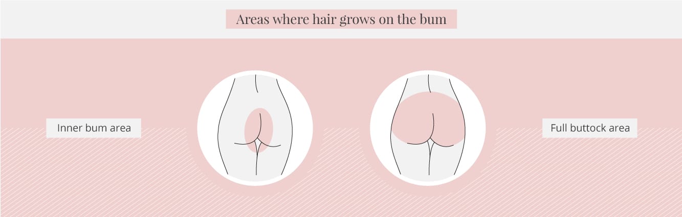 Areas where hair grows on the bum area