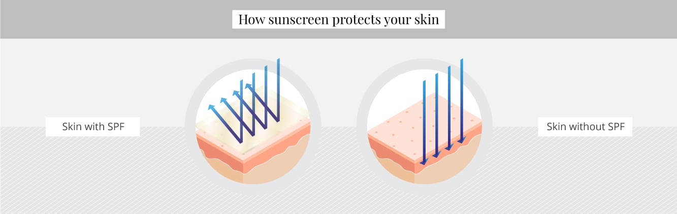 How sunscreen protects your skin