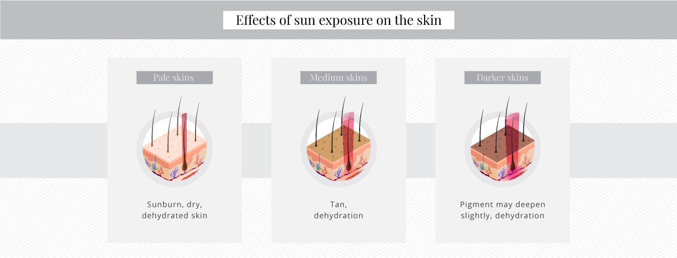 Effects of sun exposure on the skin