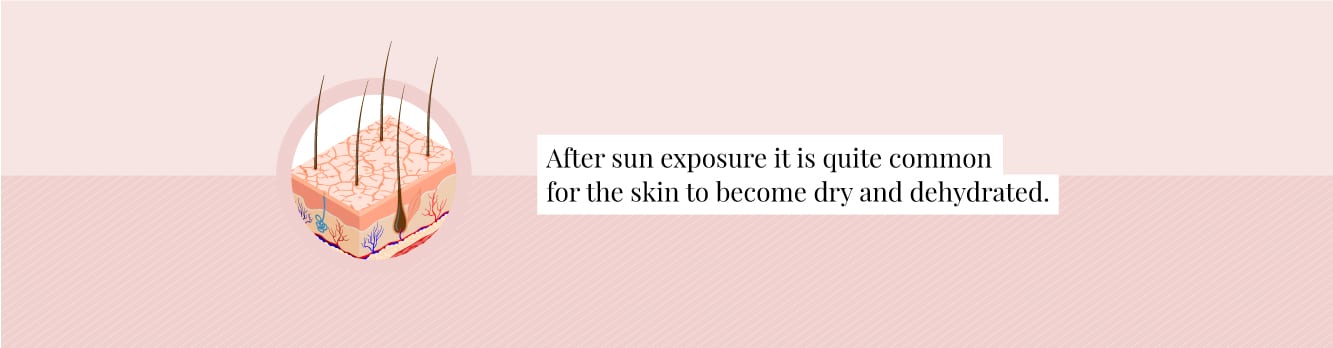 Sun exposure can make skin dehydrated and can cause issues with laser hair removal 