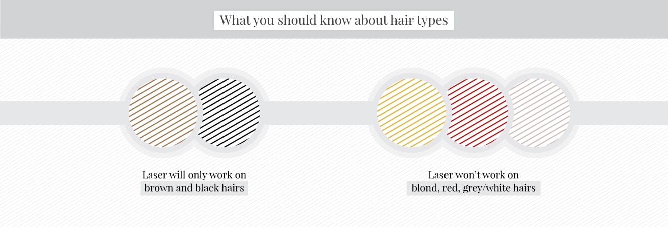 What hair types are suitable for laser hair removal