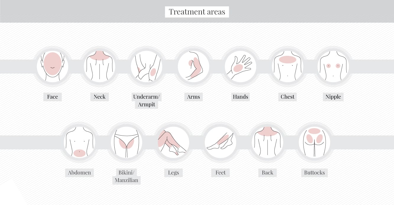 Treatment areas suitable for laser hair removal