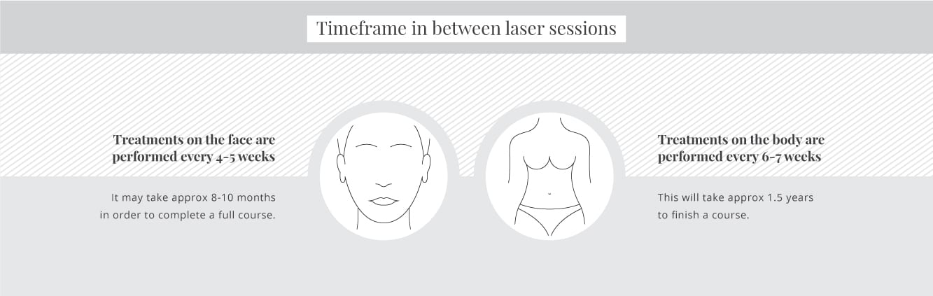 Timeframes in between laser sessions