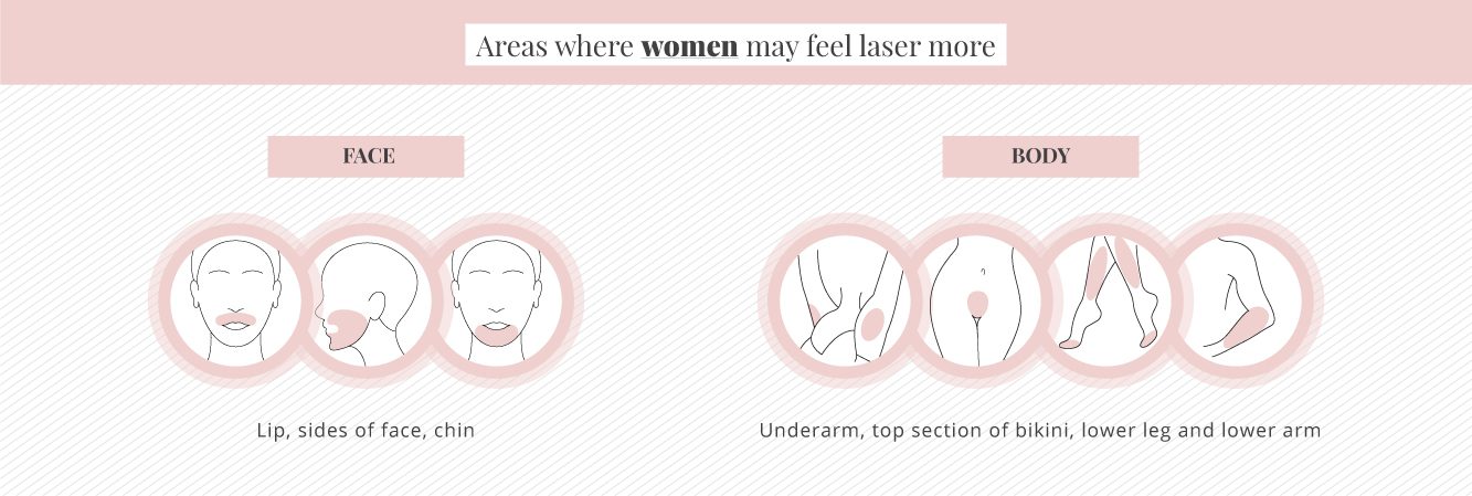 Areas where laser may hurt more for women